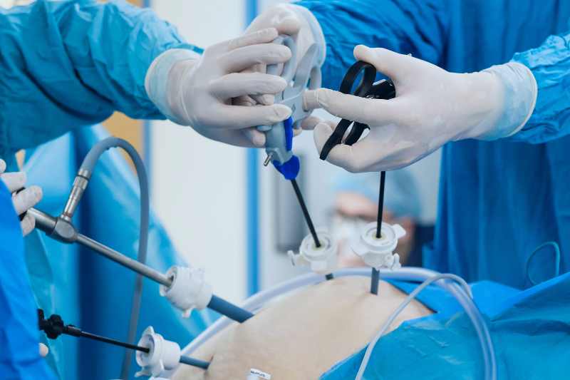 endoscopic