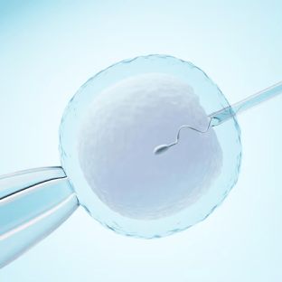 ivf-service