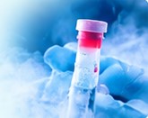 Fertility preservation
