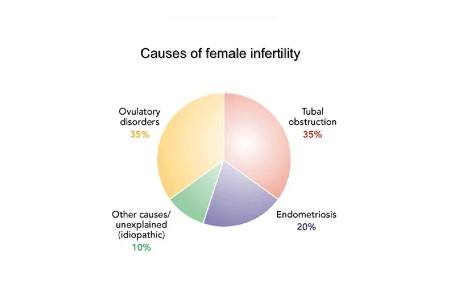 Tubal-Factor-Disorder